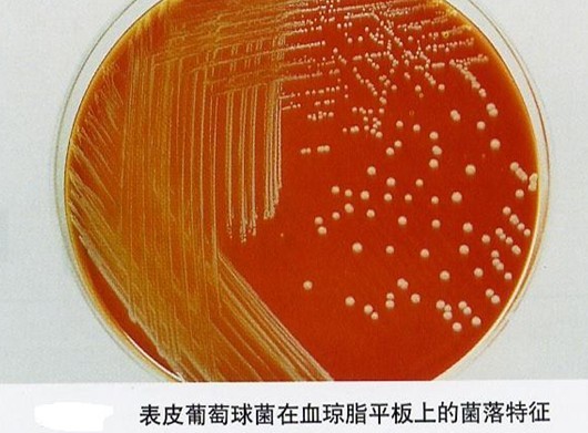 表皮葡萄球菌在血琼脂平板上的菌落特征